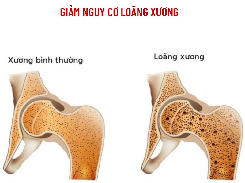 ăn chay giúp giảm nguy cơ bị loãng xương