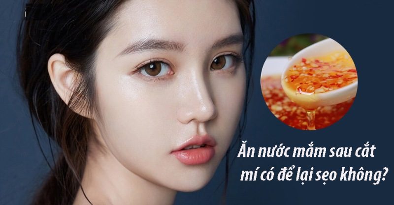 Ăn nước mắm có để lại sẹo? Nguồn gốc của lời đồn: