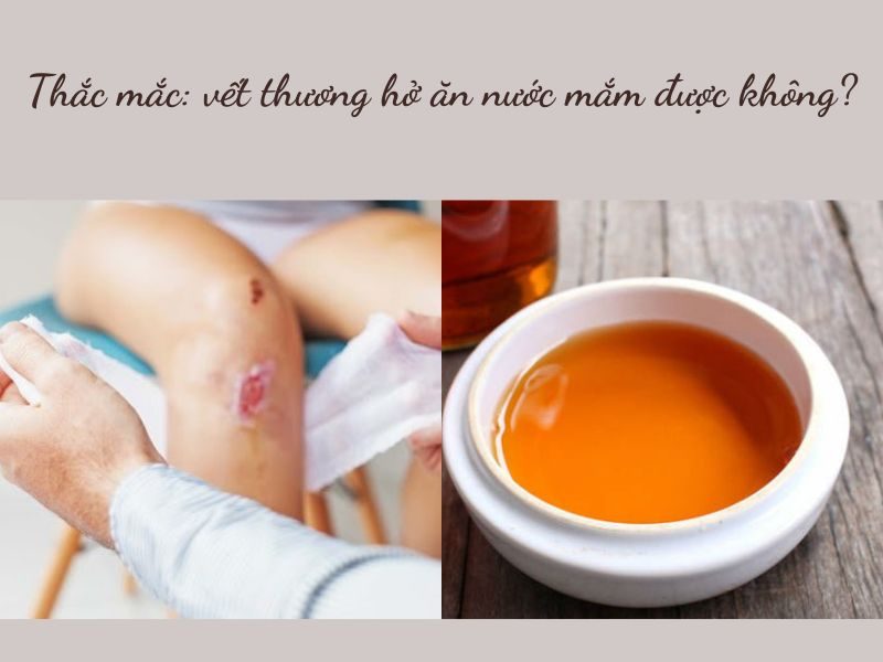Ăn nước mắm có để lại sẹo? Nguồn gốc của lời đồn: