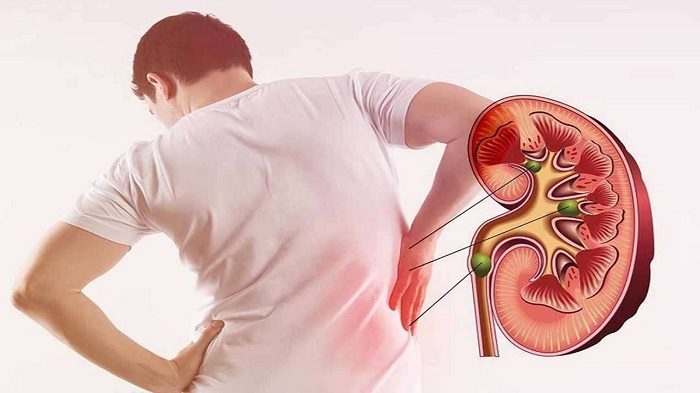 Tác hại của việc sử dụng nước mắm không an toàn