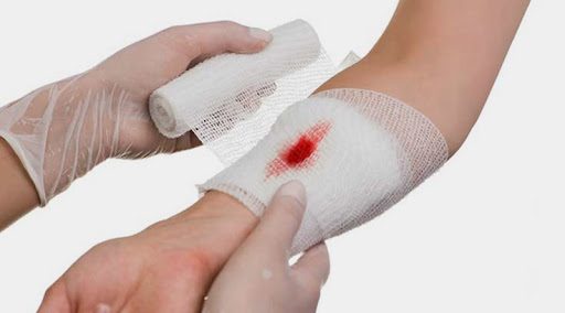 Chăm sóc vết thương đúng cách: